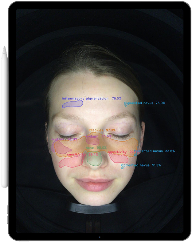 MoreMe Skin Analysis Conditions