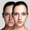 pigmentation